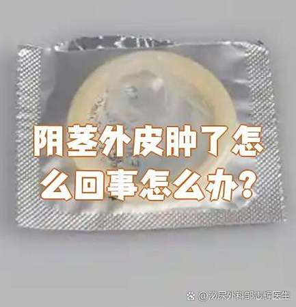 生殖外皮肿大是什么原因