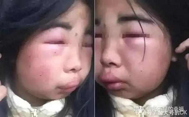 被女朋友打了耳光该不该还手