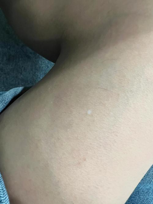 投影仪投屏出现白点