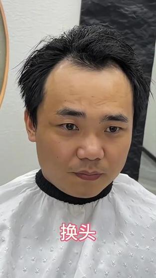 头发头顶稀少理了短头发了
