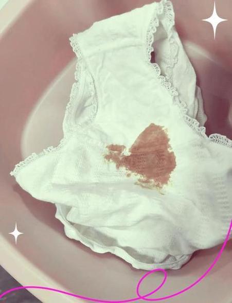 如何正确清洗内裤避免发黄