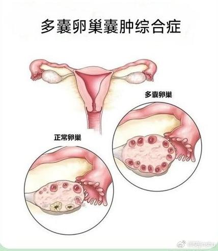 卵巢病变的症状有哪些