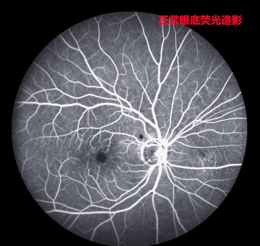 查眼睛需要拍什么片子