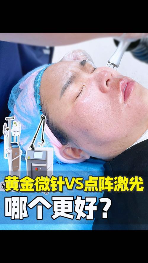 点阵激光和黄金微针哪个效果好