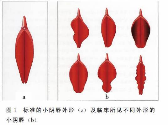 正常阴脣的图片和症状