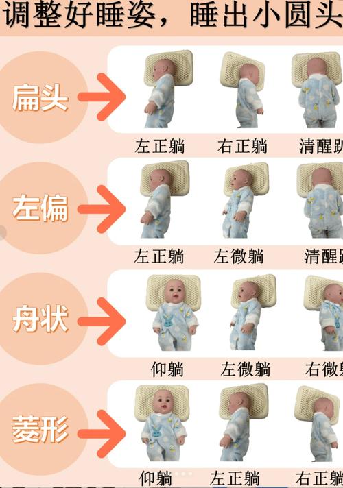 婴儿睡头型几个月定型