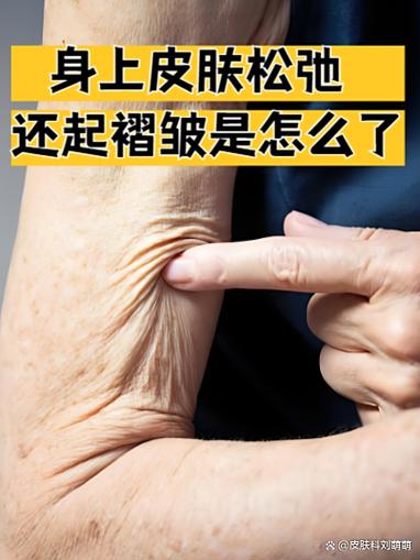 皮肤分析