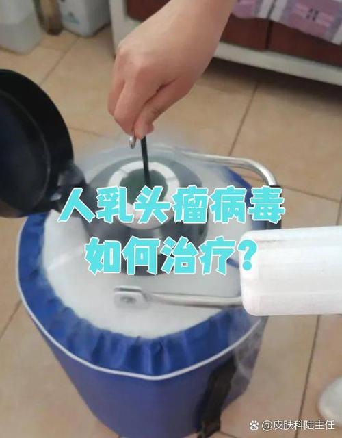 hpv物理治疗怎么治疗缩略图