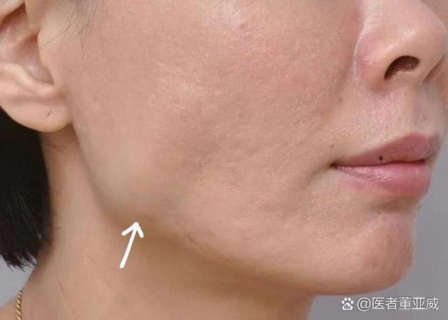 脸发紧是什么病的前兆图标