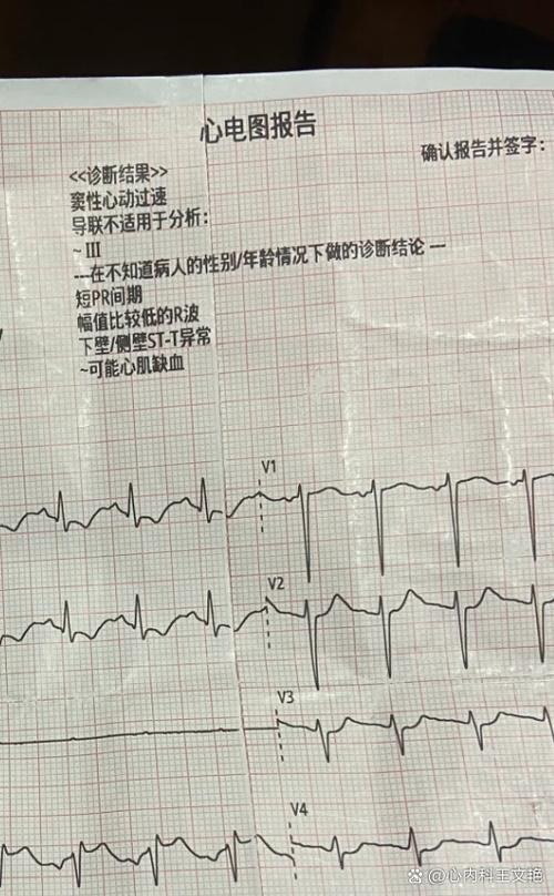 心跳120次要警惕四种病
