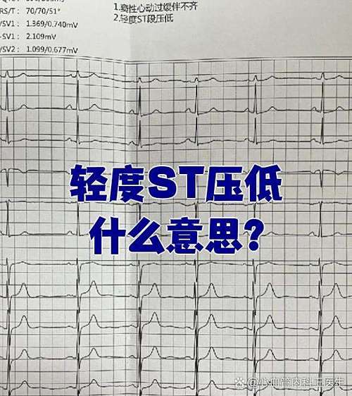 部分st段压低说明什么
