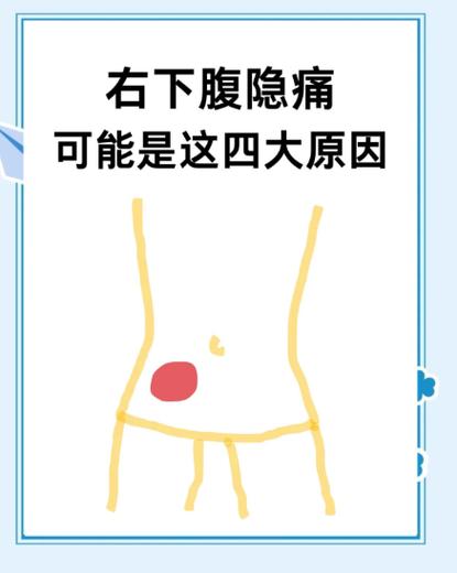 身体右下腹隐隐作痛什么原因缩略图
