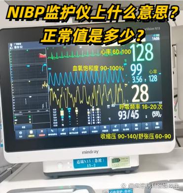无创血压nibp