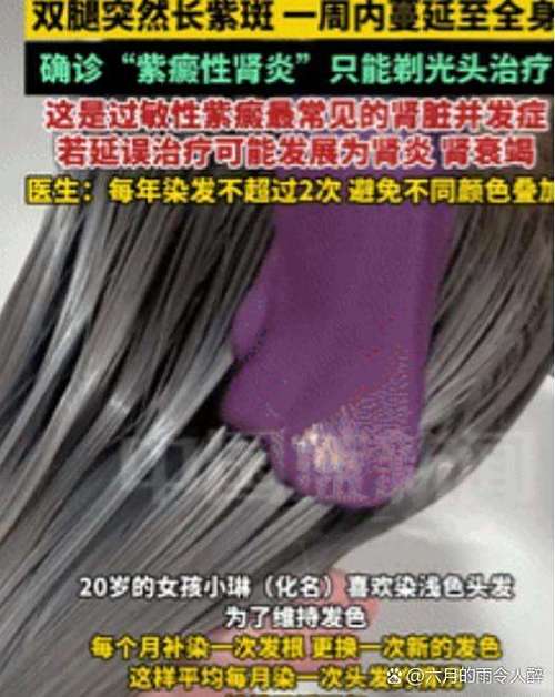 屏幕上出现紫斑会扩散