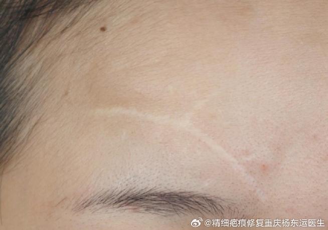 电视机中间出现一条白线
