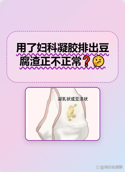用触爱cici排出物介绍