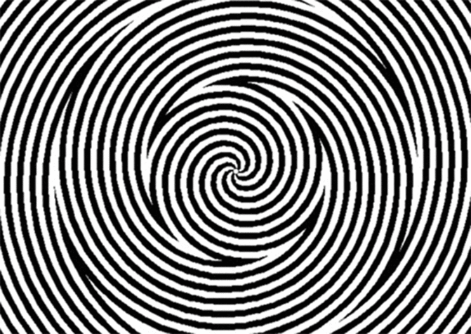 一闭眼就出现各种动态幻觉