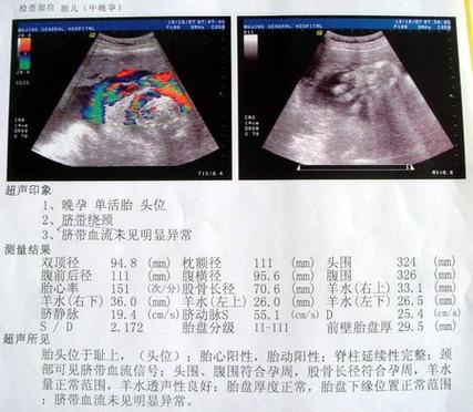 怎么从b超单看多少周