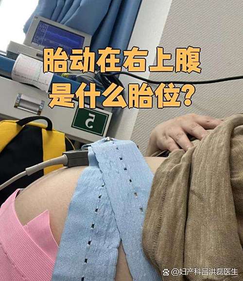 横位的胎动特点截图