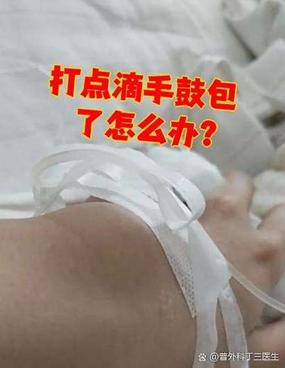 打完吊针手肿了怎么办