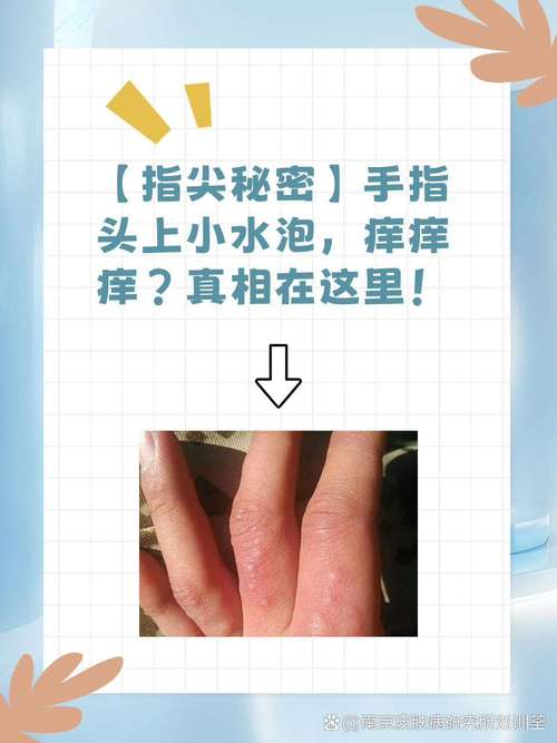 手指发麻是什么原因