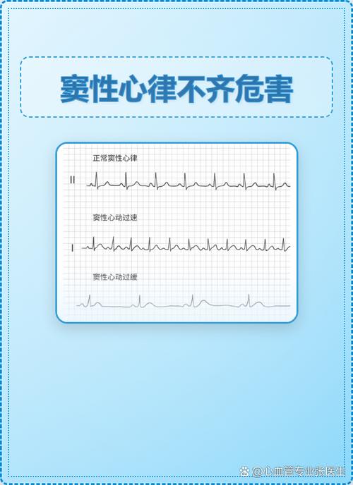 心律不规则是什么原因