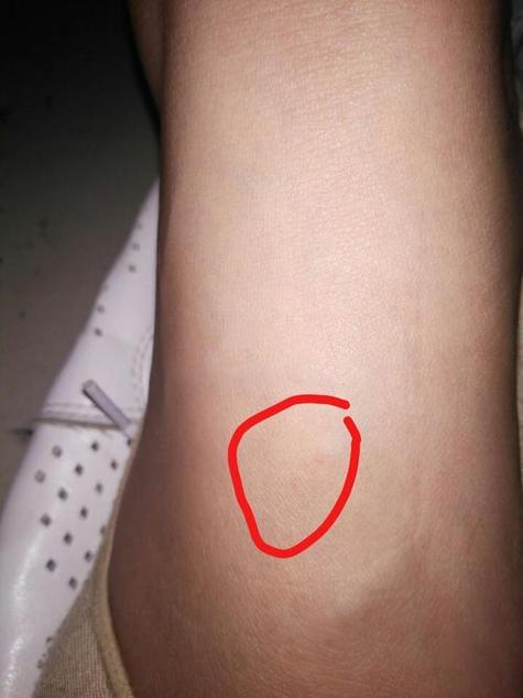 狗牙咬的什么印图片