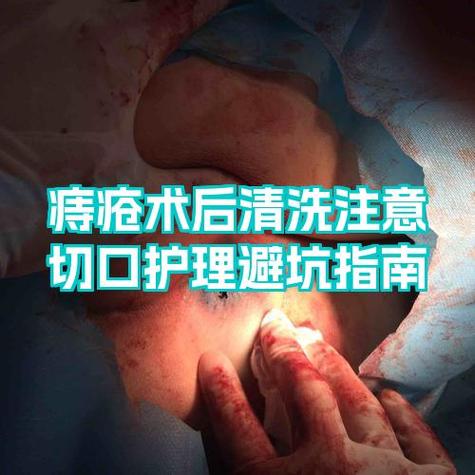 一点红治痔疮用法