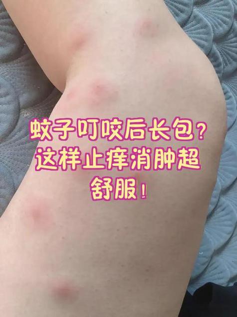消肿小妙招6个