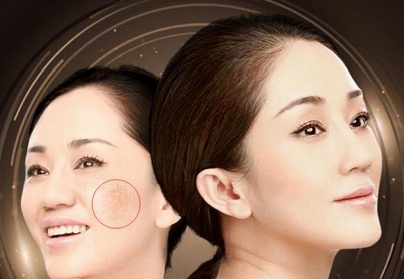 秒皮祛斑多少钱一次缩略图