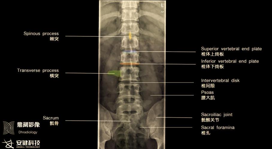 正侧位ap和lat代表