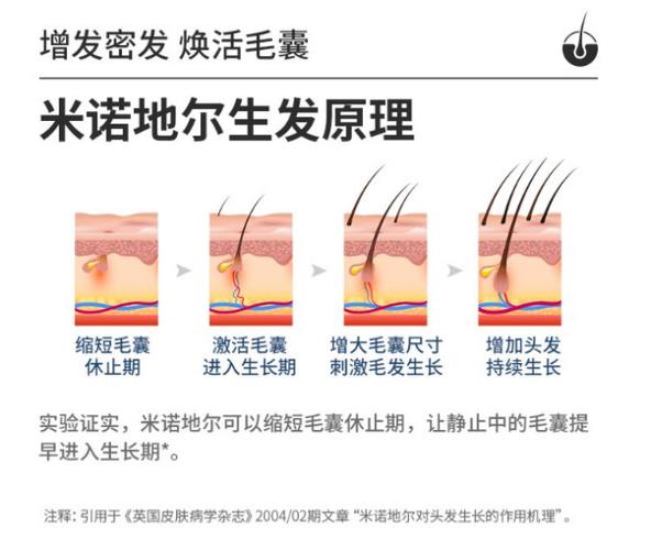 米诺地尔一旦用了就不能停吗