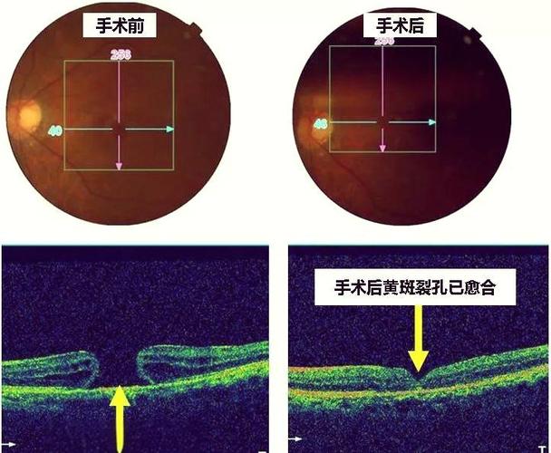手机黄斑怎么去除