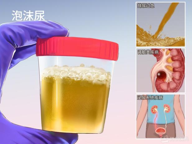 小伙长期乱吃药致终身透析