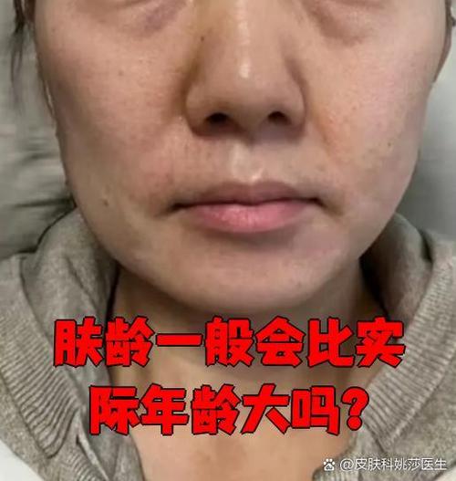 美妆美图测肤龄准吗