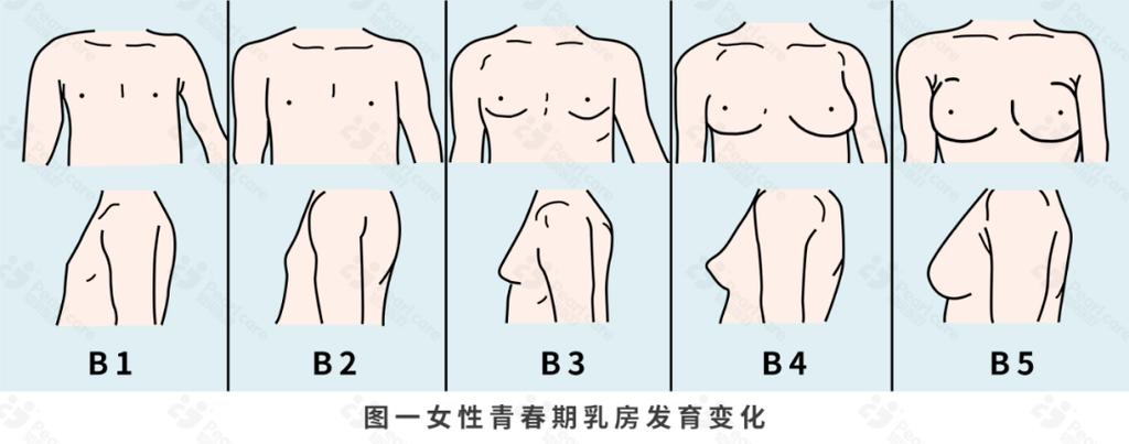 孩子穿上胸罩变成女孩子子缩略图