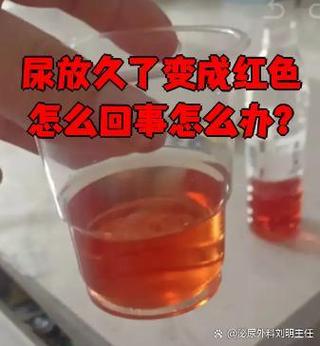 照片放久了变红怎么办