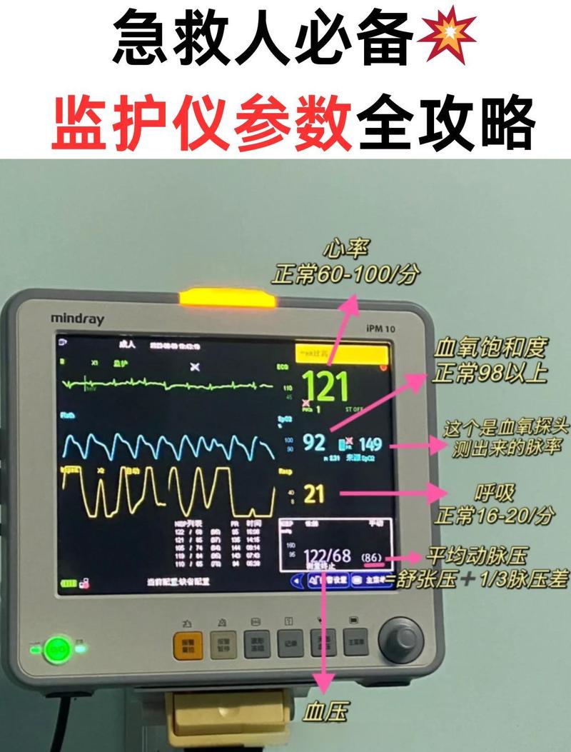 监护仪的音量怎么调截图