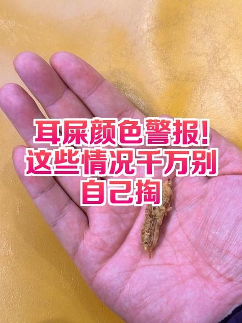 耳机进耳屎怎么清理