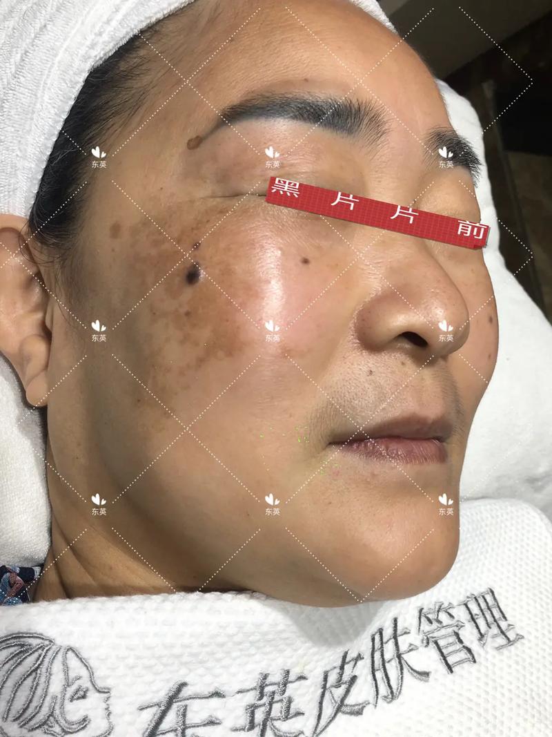 修图的黑点又叫什么