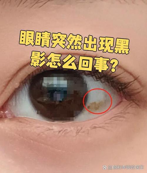 眼睛突然一黑缩略图