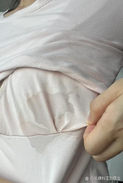 女生身上有一股奶味是怎么回事