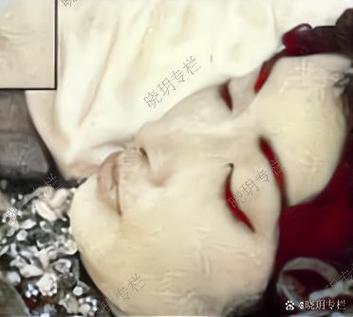 灵里沉睡的原因是什么