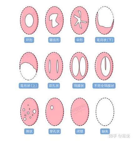 顶膜是膜有问题还是壳有问题