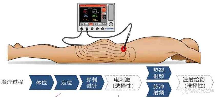 电子脉冲电表怎么调慢