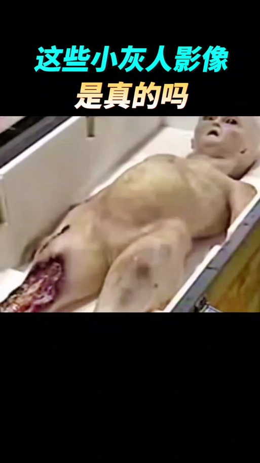 小灰人突然又恢复原图