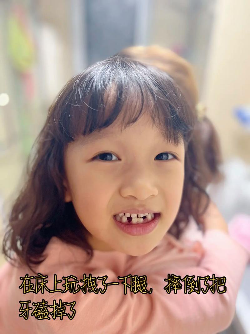 豁牙表情包图标