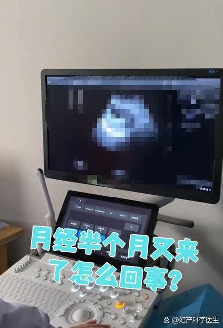 隔半个月又来月经是怎么回事缩略图