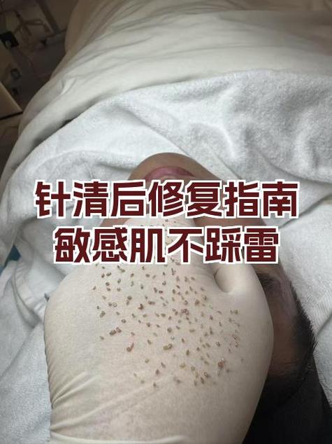 男人打降敏针的害处