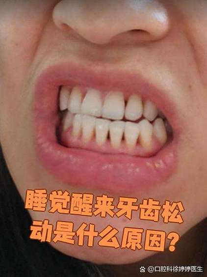 做梦牙齿松动但是没掉